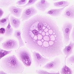Förstoring av HPV-16, en högrisktyp för cancer. 