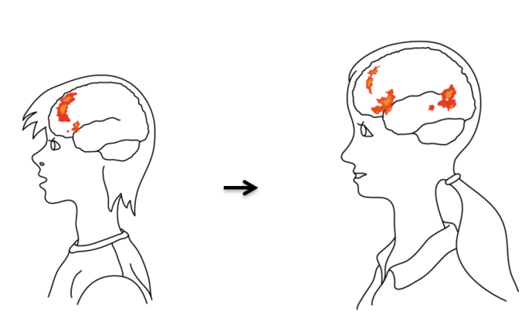 Streckbild, två unga personer med områden i hjärnan färglagda.