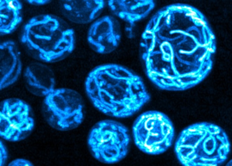 Mikroskopbild av jästceller, lysande blå "knutar" mot svart bakgrund"