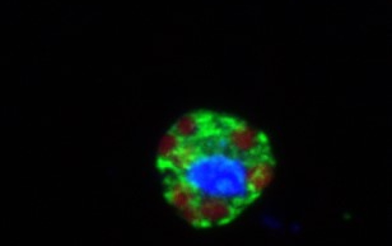 Application fluorescent in situ hybridization (FISH) to a Meringosphaera cell shows the positive hyb