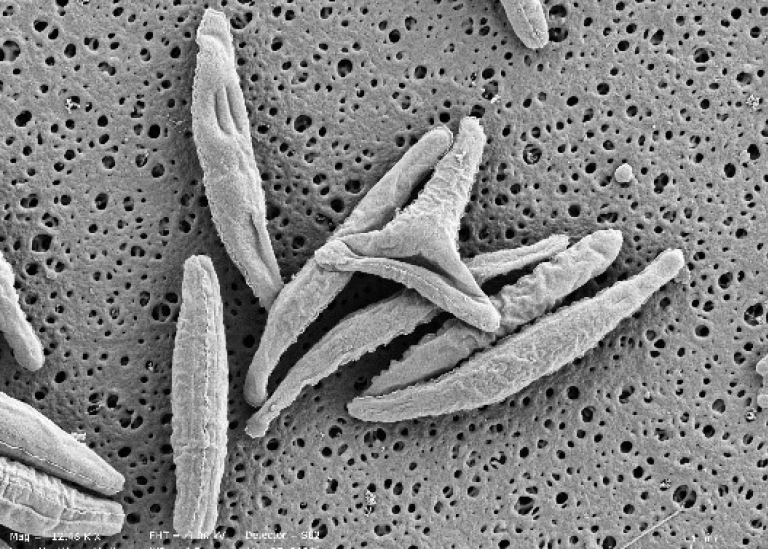 Black and white microscope image of diatoms.