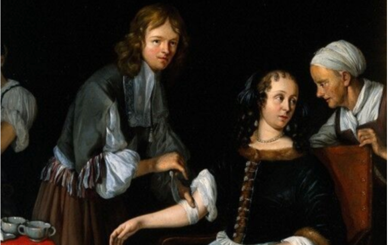 Oljemålning av Jacob Toorenvliet, 1666. Oljemålning från 1600-talet där kvinna behandlas med åderlåtning
